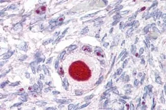 Immunohistochemical staining of human tissue sections using NR5A1 antibody (GTX13132)