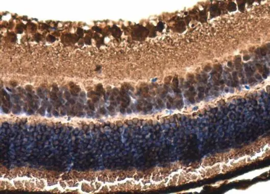 Phosducin / PDC antibody detects PDC protein at cytoplasm in mouse eye by immunohistochemical analysis. Sample: Paraffin-embedded mouse eye. Phosducin / PDC antibody (GTX131327) diluted at 1:500.
Antigen Retrieval: Citrate buffer, pH 6.0, 15 min