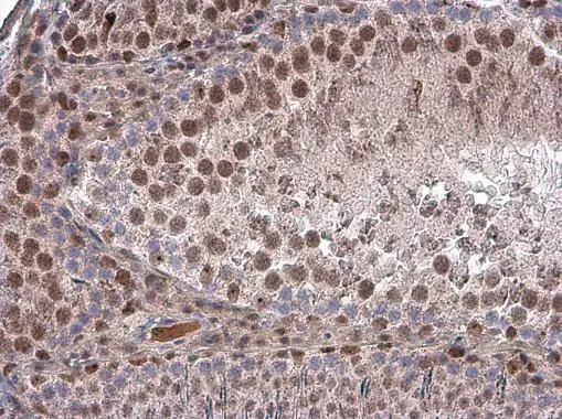 Brachyury antibody detects Brachyury protein at nucleus in rat testis by immunohistochemical analysis. Sample: Paraffin-embedded rat testis. Brachyury antibody (GTX131339) diluted at 1:2000.
Antigen Retrieval: Citrate buffer, pH 6.0, 15 min Brachyury antibody detects Brachyury protein at nucleus in rat testis by immunohistochemical analysis. Sample: Paraffin-embedded rat testis. Brachyury antibody (GTX131339) diluted at 1:2000.
Antigen Retrieval: Citrate buffer, pH 6.0, 15 min