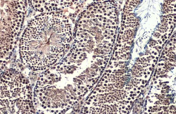 Brachyury antibody detects Brachyury protein at nucleus by immunohistochemical analysis. Sample: Paraffin-embedded mouse testis. Brachyury stained by Brachyury antibody (GTX131339) diluted at 1:500. Antigen Retrieval: Citrate buffer, pH 6.0, 15 min Brachyury antibody detects Brachyury protein at nucleus by immunohistochemical analysis. Sample: Paraffin-embedded mouse testis. Brachyury stained by Brachyury antibody (GTX131339) diluted at 1:500. Antigen Retrieval: Citrate buffer, pH 6.0, 15 min
