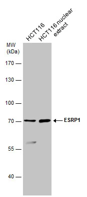 HCT116 whole cell and nuclear extracts (30 μg) were separated by 7.5% SDS-PAGE, and the membrane was blotted with ESRP1 antibody (GTX131373) diluted at 1:1000.