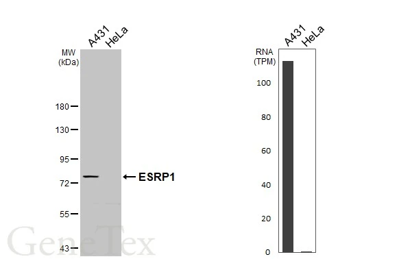 Various whole cell extracts (30 μg) were separated by 7.5% SDS-PAGE, and the membrane was blotted with ESRP1 antibody (GTX131373) diluted at 1:1000. The HRP-conjugated anti-rabbit IgG antibody (GTX213110-01) was used to detect the primary antibody. Corresponding RNA expression data for the same cell lines are based on Human Protein Atlas program.