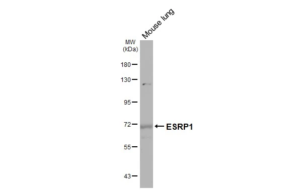 Mouse tissue extract (50 μg) was separated by 7.5% SDS-PAGE, and the membrane was blotted with ESRP1 antibody (GTX131373) diluted at 1:1000. The HRP-conjugated anti-rabbit IgG antibody (GTX213110-01) was used to detect the primary antibody, and the signal was developed with Trident ECL plus-Enhanced.