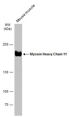 Mouse tissue extract (50 μg) was separated by 5% SDS-PAGE, and the membrane was blotted with Myosin Heavy Chain 11 antibody (GTX131414) diluted at 1:500. The HRP-conjugated anti-rabbit IgG antibody (GTX213110-01) was used to detect the primary antibody.