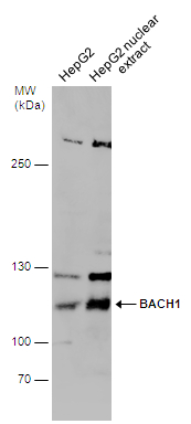 HepG2 whole cell and nuclear extracts (30 μg) were separated by 5% SDS-PAGE, and the membrane was blotted with BACH1 antibody (GTX131429) diluted at 1:1000.