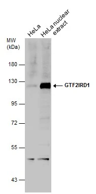 HeLa whole cell and nuclear extracts (30 μg) were separated by 7.5% SDS-PAGE, and the membrane was blotted with GTF2IRD1 antibody (GTX131433) diluted at 1:500.