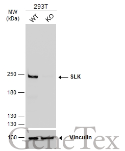 Wild-type (WT) and SLK knockout (KO) 293T cell extracts (30 μg) were separated by 5% SDS-PAGE, and the membrane was blotted with SLK antibody (GTX131438) diluted at 1:1000. The HRP-conjugated anti-rabbit IgG antibody (GTX213110-01) was used to detect the primary antibody.