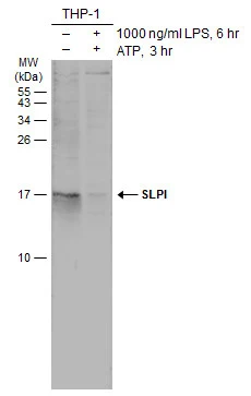 Untreated (–) and treated (+) THP-1 whole cell extracts (30 μg) were separated by 15% SDS-PAGE, and the membrane was blotted with SLPI antibody (GTX131447) diluted at 1:1000. The HRP-conjugated anti-rabbit IgG antibody (GTX213110-01) was used to detect the primary antibody.