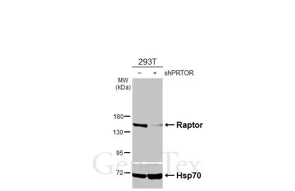 Non-transfected (–) and transfected (+) 293T whole cell extracts (30 μg) were separated by 7.5% SDS-PAGE, and the membrane was blotted with Raptor antibody (GTX131508) diluted at 1:3000. The HRP-conjugated anti-rabbit IgG antibody (GTX213110-01) was used to detect the primary antibody.