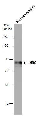 Human plasma (30 μg) was separated by 7.5% SDS-PAGE, and the membrane was blotted with HRG antibody (GTX131514) diluted at 1:1000.
