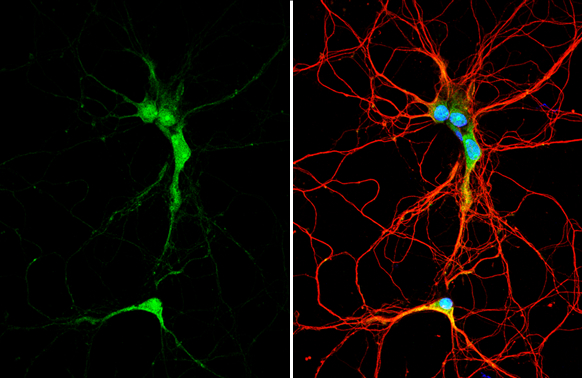FTO antibody detects FTO protein by immunofluorescent analysis. Sample: DIV9 rat E18 primary hippocampal neuron cells were fixed in 4% paraformaldehyde at RT for 15 min. Green: FTO stained by FTO antibody (GTX131517) diluted at 1:500. Red: beta Tubulin 3/ Tuj1, stained by beta Tubulin 3/ Tuj1 antibody [GT11710] (GTX631836) diluted at 1:500. Blue: Fluoroshield with DAPI (GTX30920).