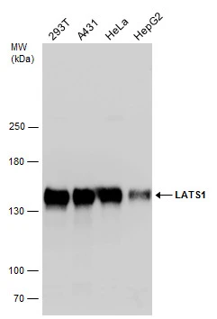 Various whole cell extracts (30 μg) were separated by 5% SDS-PAGE, and the membrane was blotted with LATS1 antibody (GTX131532) diluted at 1:1000.