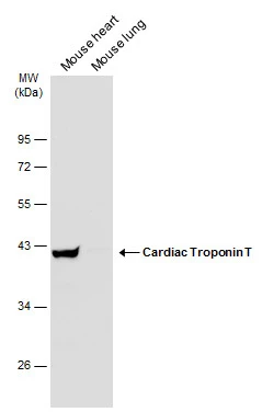Various tissue extracts (50 μg) were separated by 10% SDS-PAGE, and the membrane was blotted with Cardiac Troponin T antibody (GTX131562) diluted at 1:1000. The HRP-conjugated anti-rabbit IgG antibody (GTX213110-01) was used to detect the primary antibody.