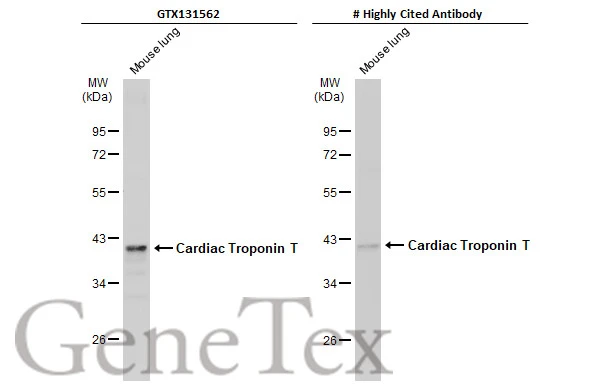 Mouse tissue extract (50 μg) was separated by 10% SDS-PAGE, and the membranes were blotted with Cardiac Troponin T antibody (GTX131562) diluted at 1:3000 and competitor's antibody diluted at 1:3000. The HRP-conjugated anti-rabbit IgG antibody (GTX213110-01) was used to detect the primary antibody, and the signal was developed with Trident ECL plus-Enhanced. *The competitor is not affiliated with GeneTex and does not endorse this product.