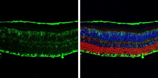 COL9A3 antibody detects COL9A3 protein at cell membrane by immunohistochemical analysis. Sample: Paraffin-embedded mouse eye. Green: COL9A3 stained by COL9A3 antibody (GTX131602) diluted at 1:500. Red: beta Tubulin 3/ Tuj1, a cytoskeleton marker, stained by beta Tubulin 3/ Tuj1 antibody [GT1338] (GTX631831) diluted at 1:500. Blue: Fluoroshield with DAPI (GTX30920). Antigen Retrieval: Citrate buffer, pH 6.0, 15 min