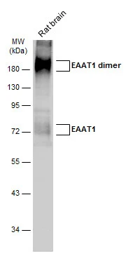 Rat tissue extract (50 μg) was separated by 10% SDS-PAGE, and the membrane was blotted with EAAT1 antibody (GTX131623) diluted at 1:1000. The HRP-conjugated anti-rabbit IgG antibody (GTX213110-01) was used to detect the primary antibody.
