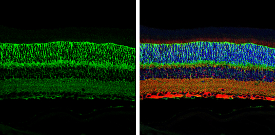 EAAT1 antibody detects EAAT1 protein at cell membrane and cytoplasm by immunohistochemical analysis. Sample: Paraffin-embedded mouse eye. Green: EAAT1 stained by EAAT1 antibody (GTX131623) diluted at 1:750. Red: beta Tubulin 3/ Tuj1, a cytoskeleton marker, stained by beta Tubulin 3/ Tuj1 antibody [GT1338] (GTX631831) diluted at 1:500. Blue: Fluoroshield with DAPI (GTX30920).
