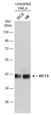 Unboiled HeLa whole cell and membrane extracts (30 μg) were separated by 10% SDS-PAGE, and the membrane was blotted with MCT4 antibody (GTX131626) diluted at 1:1000. The HRP-conjugated anti-rabbit IgG antibody (GTX213110-01) was used to detect the primary antibody. (WCE: whole cell extract; ME: membrane extract)