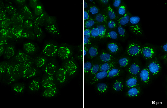 GALNT3 antibody detects GALNT3 protein at Golgi apparatus by immunofluorescent analysis. Sample: A431 cells were fixed in ice-cold MeOH for 5 min. Green: GALNT3 stained by GALNT3 antibody (GTX131628) diluted at 1:500. Blue: Hoechst 33342 staining. Scale bar= 10 μm.