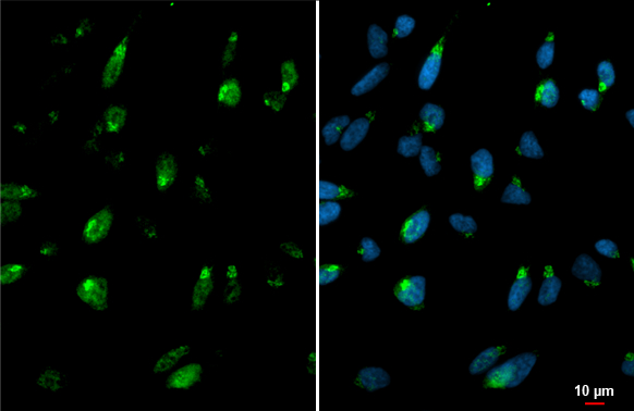 GALNT3 antibody detects GALNT3 protein at Golgi by immunofluorescent analysis. Sample: HeLa cells were fixed in 4% paraformaldehyde at RT for 15 min. Green: GALNT3 stained by GALNT3 antibody (GTX131628) diluted at 1:3000. Blue: Fluoroshield with DAPI (GTX30920).