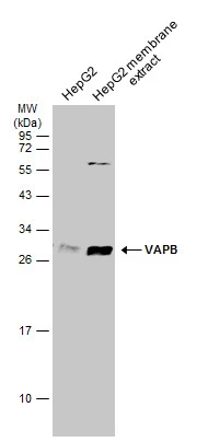 HepG2 whole cell and membrane extracts (30 μg) were separated by 12% SDS-PAGE, and the membrane was blotted with VAPB antibody (GTX131631) diluted at 1:1000. The HRP-conjugated anti-rabbit IgG antibody (GTX213110-01) was used to detect the primary antibody.