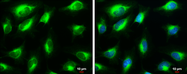 VAPB antibody detects VAPB protein at endoplasmic reticulum by immunofluorescent analysis. Sample: HeLa cells were fixed in 4% paraformaldehyde at RT for 15 min. Green: VAPB stained by VAPB antibody (GTX131631) diluted at 1:1000. Blue: Hoechst 33342 staining. Scale bar= 10μm.