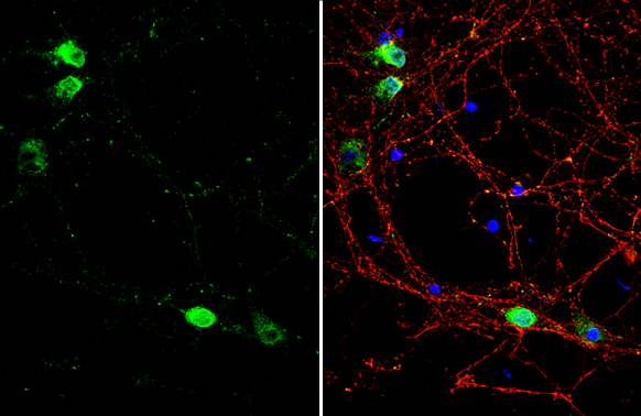 VAPB antibody detects VAPB protein by immunofluorescent analysis. Sample: DIV9 rat E18 primary cortical neuron cells were fixed in 4% paraformaldehyde at RT for 15 min. Green: VAPB stained by VAPB antibody (GTX131631) diluted at 1:500. Red: Tau, stained by Tau antibody [GT287] (GTX634809) diluted at 1:500. Blue: Fluoroshield with DAPI (GTX30920).
