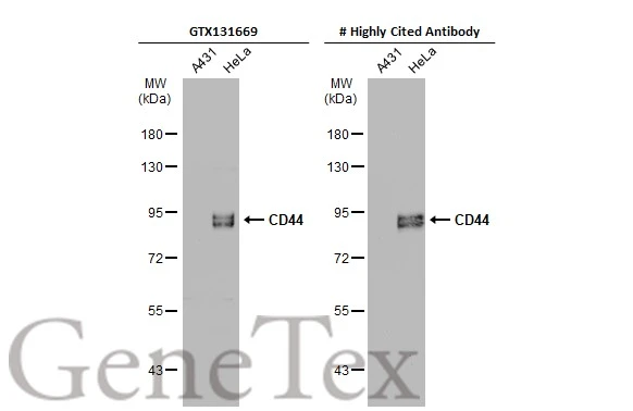 Various whole cell extracts (30 μg) were separated by 7.5% SDS-PAGE, and the membranes were blotted with CD44 antibody (GTX131669) diluted at 1:500 and competitor's antibody diluted at 1:500. The HRP-conjugated anti-rabbit IgG antibody (GTX213110-01) was used to detect the primary antibody. *The competitor is not affiliated with GeneTex and does not endorse this product. Various whole cell extracts (30 μg) were separated by 7.5% SDS-PAGE, and the membranes were blotted with CD44 antibody (GTX131669) diluted at 1:500 and competitor's antibody diluted at 1:500. The HRP-conjugated anti-rabbit IgG antibody (GTX213110-01) was used to detect the primary antibody. *The competitor is not affiliated with GeneTex and does not endorse this product.