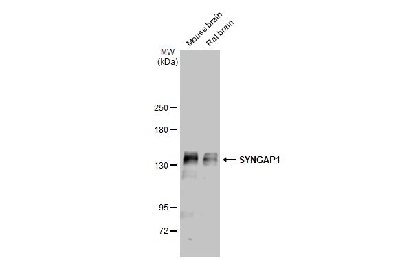 Various tissue extracts (50 microg) were separated by 5% SDS-PAGE, and the membrane was blotted with SYNGAP1 antibody (GTX131673) diluted at 1:1000. The HRP-conjugated anti-rabbit IgG antibody (GTX213110-01) was used to detect the primary antibody.