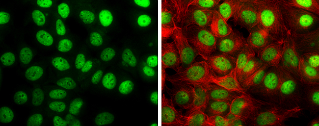 TIF1 gamma antibody detects TIF1 gamma protein at nucleus by immunofluorescent analysis. Sample: MCF-7 cells were fixed in 4% paraformaldehyde at RT for 15 min. Green: TIF1 gamma stained by TIF1 gamma antibody (GTX131686) diluted at 1:2000. Red: alpha Tubulin, a cytoskeleton marker, stained by alpha Tubulin antibody [GT114] (GTX628802) diluted at 1:500.
