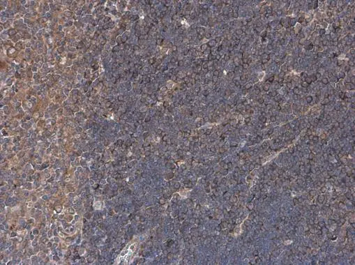 CD169 antibody detects CD169 protein at cell membrane by immunohistochemical analysis. Sample: Paraffin-embedded mouse thymus gland. CD169 stained by CD169 antibody (GTX131703) diluted at 1:500.
Antigen Retrieval: Citrate buffer, pH 6.0, 15 min CD169 antibody detects CD169 protein at cell membrane by immunohistochemical analysis. Sample: Paraffin-embedded mouse thymus gland. CD169 stained by CD169 antibody (GTX131703) diluted at 1:500.
Antigen Retrieval: Citrate buffer, pH 6.0, 15 min