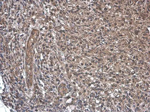 CD169 antibody detects CD169 protein at cytoplasm by immunohistochemical analysis. Sample: Paraffin-embedded mouse lymph node. CD169 stained by CD169 antibody (GTX131703) diluted at 1:500.
Antigen Retrieval: Citrate buffer, pH 6.0, 15 min CD169 antibody detects CD169 protein at cytoplasm by immunohistochemical analysis. Sample: Paraffin-embedded mouse lymph node. CD169 stained by CD169 antibody (GTX131703) diluted at 1:500.
Antigen Retrieval: Citrate buffer, pH 6.0, 15 min