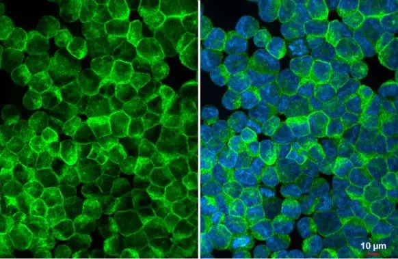 CD169 antibody detects CD169 protein at cell membrane by immunofluorescent analysis. Sample: K562 cells were fixed in 4% paraformaldehyde at RT for 15 min. Green: CD169 stained by CD169 antibody (GTX131703) diluted at 1:500. Blue: Fluoroshield with DAPI (GTX30920).