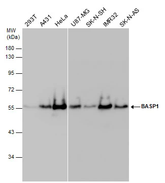 BASP1 antibody detects BASP1 protein by western blot analysis. Various whole cell extracts (30 μg) were separated by 10% SDS-PAGE, and the membrane was blotted with BASP1 antibody (GTX131728) diluted at 1:1000.
