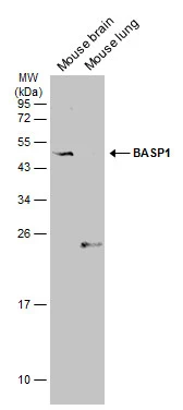 Mouse tissue extract (50 μg) were separated by 12% SDS-PAGE, and the membrane was blotted with BASP1 antibody (GTX131728) diluted at 1:1000. The HRP-conjugated anti-rabbit IgG antibody (GTX213110-01) was used to detect the primary antibody, and the signal was developed with Trident ECL plus-Enhanced.