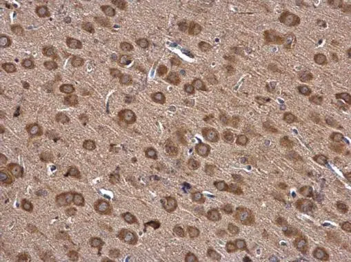 IARS antibody