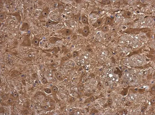 FSD1 antibody detects FSD1 protein at cytoplasm and nucleus in mouse brain by immunohistochemical analysis. Sample: Paraffin-embedded mouse brain. FSD1 antibody (GTX131769) diluted at 1:1200. 
 Antigen Retrieval: Citrate buffer, pH 6.0, 15 min