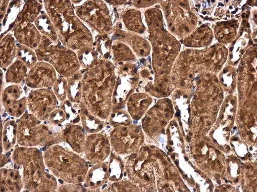 CHD3 antibody detects CHD3 protein at cytoplasm and nucleus in mouse kidney by immunohistochemical analysis. Sample: Paraffin-embedded mouse kidney. CHD3 antibody (GTX131779) diluted at 1:500. 
 Antigen Retrieval: Citrate buffer, pH 6.0, 15 min