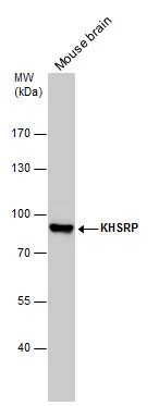 KHSRP antibody detects KHSRP protein by western blot analysis. Mouse tissue extracts (50 μg) was separated by 7.5% SDS-PAGE, and the membrane was blotted with KHSRP antibody (GTX131804) diluted at 1:1000.