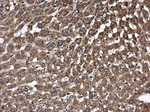 PCB antibody detects PCB protein at mitochondria and cytoplasm in mouse liver by immunohistochemical analysis. Sample: Paraffin-embedded mouse liver. PCB antibody (GTX131987) diluted at 1:500.
Antigen Retrieval: Citrate buffer, pH 6.0, 15 min PCB antibody detects PCB protein at mitochondria and cytoplasm in mouse liver by immunohistochemical analysis. Sample: Paraffin-embedded mouse liver. PCB antibody (GTX131987) diluted at 1:500.
Antigen Retrieval: Citrate buffer, pH 6.0, 15 min
