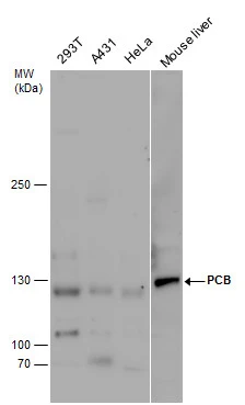 PCB antibody detects PCB protein by western blot analysis. Various whole cell extracts (30 μg) and Mouse tissue extracts (50 μg) were separated by 5% SDS-PAGE, and the membrane was blotted with PCB antibody (GTX131987) diluted at a dilution of 1:1000. PCB antibody detects PCB protein by western blot analysis. Various whole cell extracts (30 μg) and Mouse tissue extracts (50 μg) were separated by 5% SDS-PAGE, and the membrane was blotted with PCB antibody (GTX131987) diluted at a dilution of 1:1000.