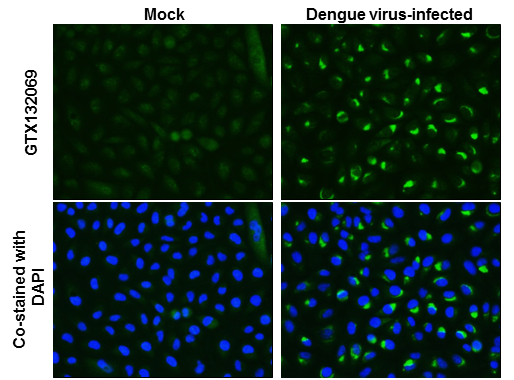 Dengue virus NS4A protein antibody detects Dengue virus NS4A protein at cytoplasm by immunofluorescent analysis. Sample: Mock and infected A549 cells were fixed in 4% paraformaldehyde at RT for 1 hr. Green: Dengue virus NS4A protein stained by Dengue virus NS4A protein antibody (GTX132069) diluted at 1:720. Blue: nuclear staining.