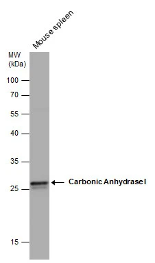 Mouse tissue extract (50 μg) was separated by 12% SDS-PAGE, and the membrane was blotted with Carbonic Anhydrase I antibody (GTX132070) diluted at 1:1000.