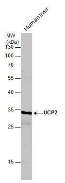 UCP2 antibody detects UCP2 protein by western blot analysis. Human tissue extracts (30 μg) was separated by 12% SDS-PAGE, and the membrane was blotted with UCP2 antibody (GTX132072) diluted at 1:1000.
