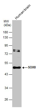 Human tissue extract (30 μg) was separated by 10% SDS-PAGE, and the membrane was blotted with SOX8 antibody (GTX132075) diluted at 1:1000.