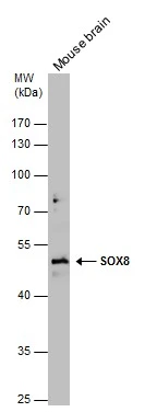 Mouse tissue extract (50 μg) was separated by 10% SDS-PAGE, and the membrane was blotted with SOX8 antibody (GTX132075) diluted at 1:1000.
