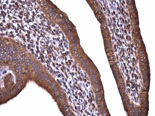 Acetyl CoA Carboxylase 1 antibody detects Acetyl CoA Carboxylase 1 protein at cytoplasm in mouse cervix by immunohistochemical analysis. Sample: Paraffin-embedded mouse cervix. Acetyl CoA Carboxylase 1 antibody (GTX132081) diluted at 1:500. 
 Antigen Retrieval: Citrate buffer, pH 6.0, 15 min