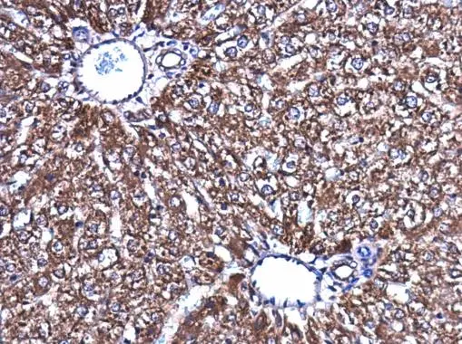 Acetyl CoA Carboxylase 1 antibody detects Acetyl CoA Carboxylase 1 protein at cytoplasm in rat liver by immunohistochemical analysis. Sample: Paraffin-embedded rat liver. Acetyl CoA Carboxylase 1 antibody (GTX132081) diluted at 1:500. 
 Antigen Retrieval: Citrate buffer, pH 6.0, 15 min
