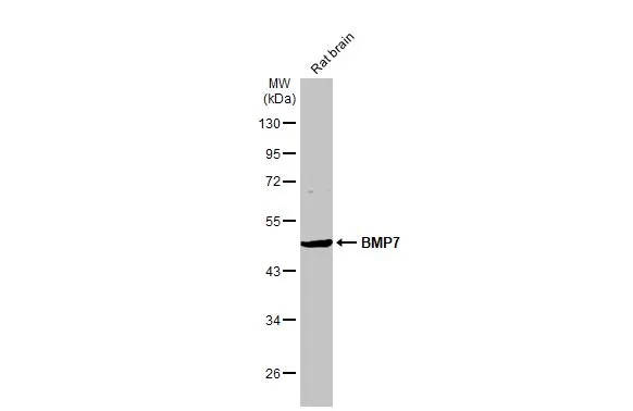Rat tissue extract (50 μg) was separated by 10% SDS-PAGE, and the membrane was blotted with BMP7 antibody (GTX132085) diluted at 1:5000. The HRP-conjugated anti-rabbit IgG antibody (GTX213110-01) was used to detect the primary antibody. Rat tissue extract (50 μg) was separated by 10% SDS-PAGE, and the membrane was blotted with BMP7 antibody (GTX132085) diluted at 1:5000. The HRP-conjugated anti-rabbit IgG antibody (GTX213110-01) was used to detect the primary antibody.