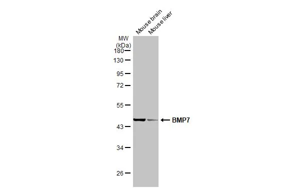 Various tissue extracts (50 μg) were separated by 10% SDS-PAGE, and the membrane was blotted with BMP7 antibody (GTX132085) diluted at 1:50000. The HRP-conjugated anti-rabbit IgG antibody (GTX213110-01) was used to detect the primary antibody. Various tissue extracts (50 μg) were separated by 10% SDS-PAGE, and the membrane was blotted with BMP7 antibody (GTX132085) diluted at 1:50000. The HRP-conjugated anti-rabbit IgG antibody (GTX213110-01) was used to detect the primary antibody.